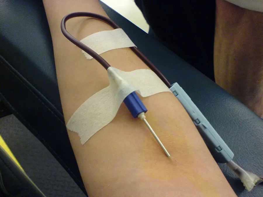 A blood donor's arm with the needle and tube in place during a donation
