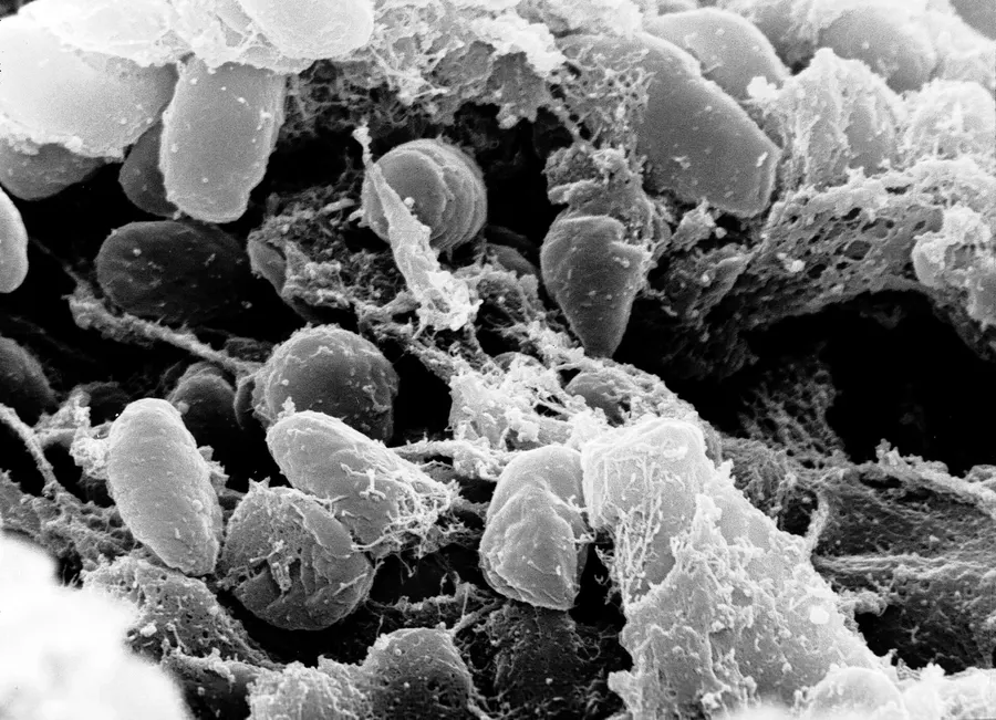 Yersinia pestis, the bacterium that causes plague, seen through a scanning electron microscope
