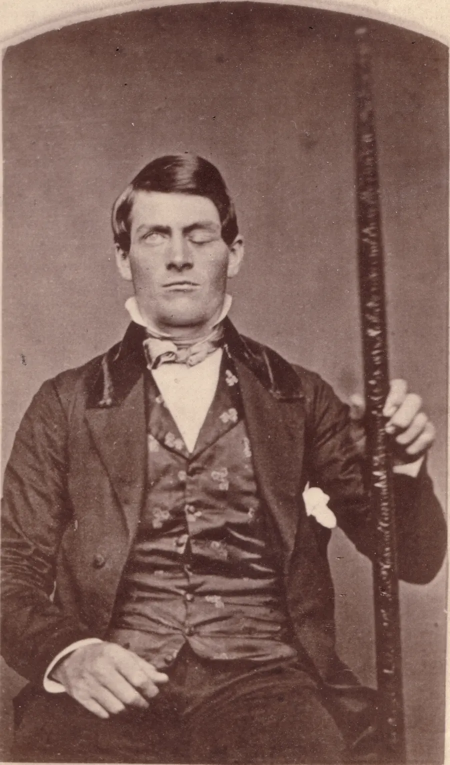 Phineas Gage, holding the tamping iron that injured him, in a cabinet-card portrait taken after his recovery